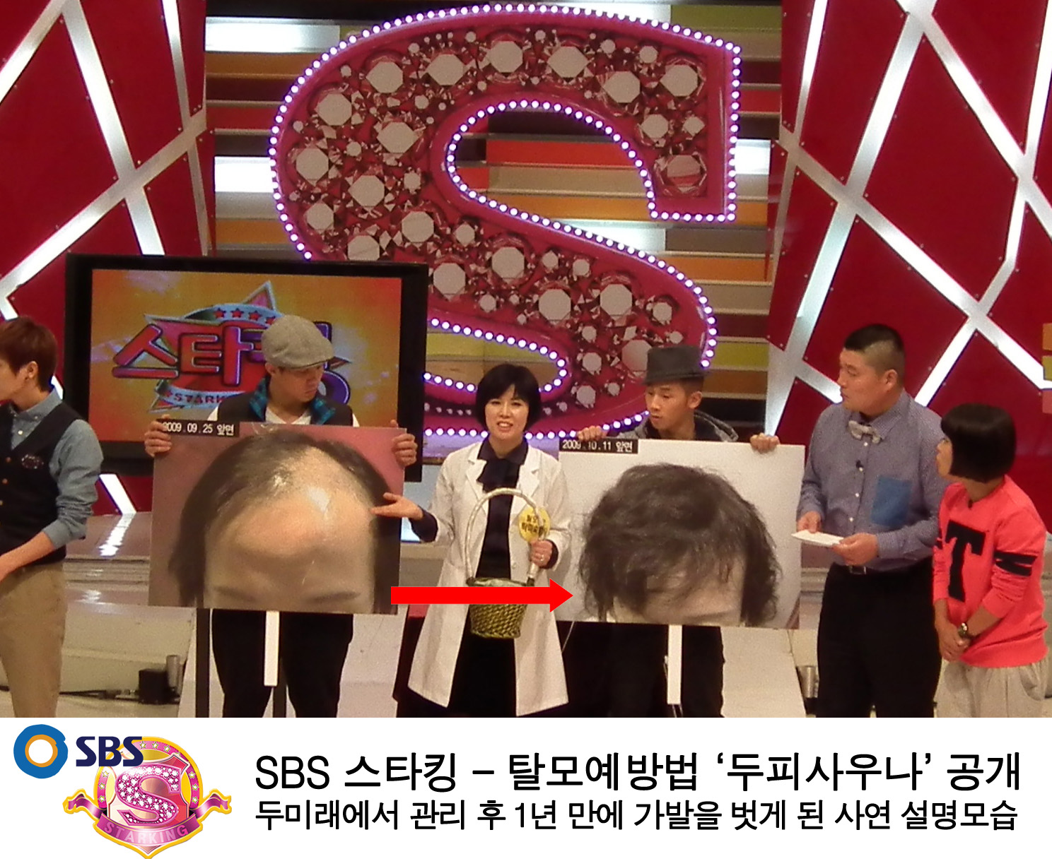 SBS 스타킹 2회
